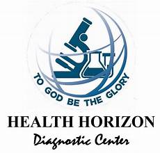 HHDC